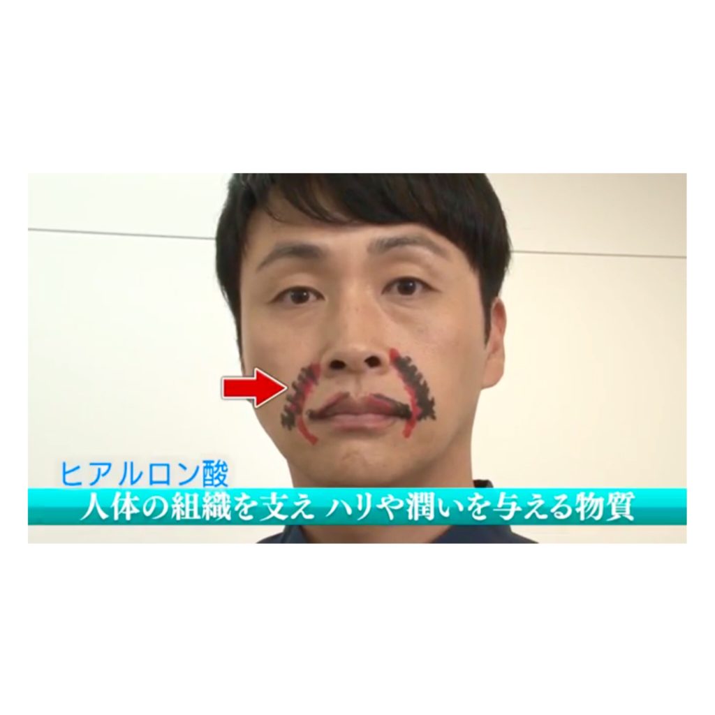 FullSizeRender 221