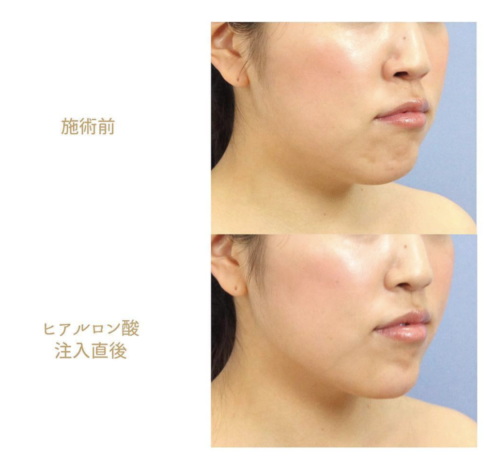 スクリーンショット 2019-02-01 14.32.16