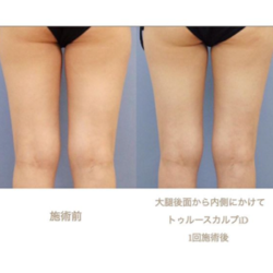 ダイエット 西川礼華 Official Blog ページ 4